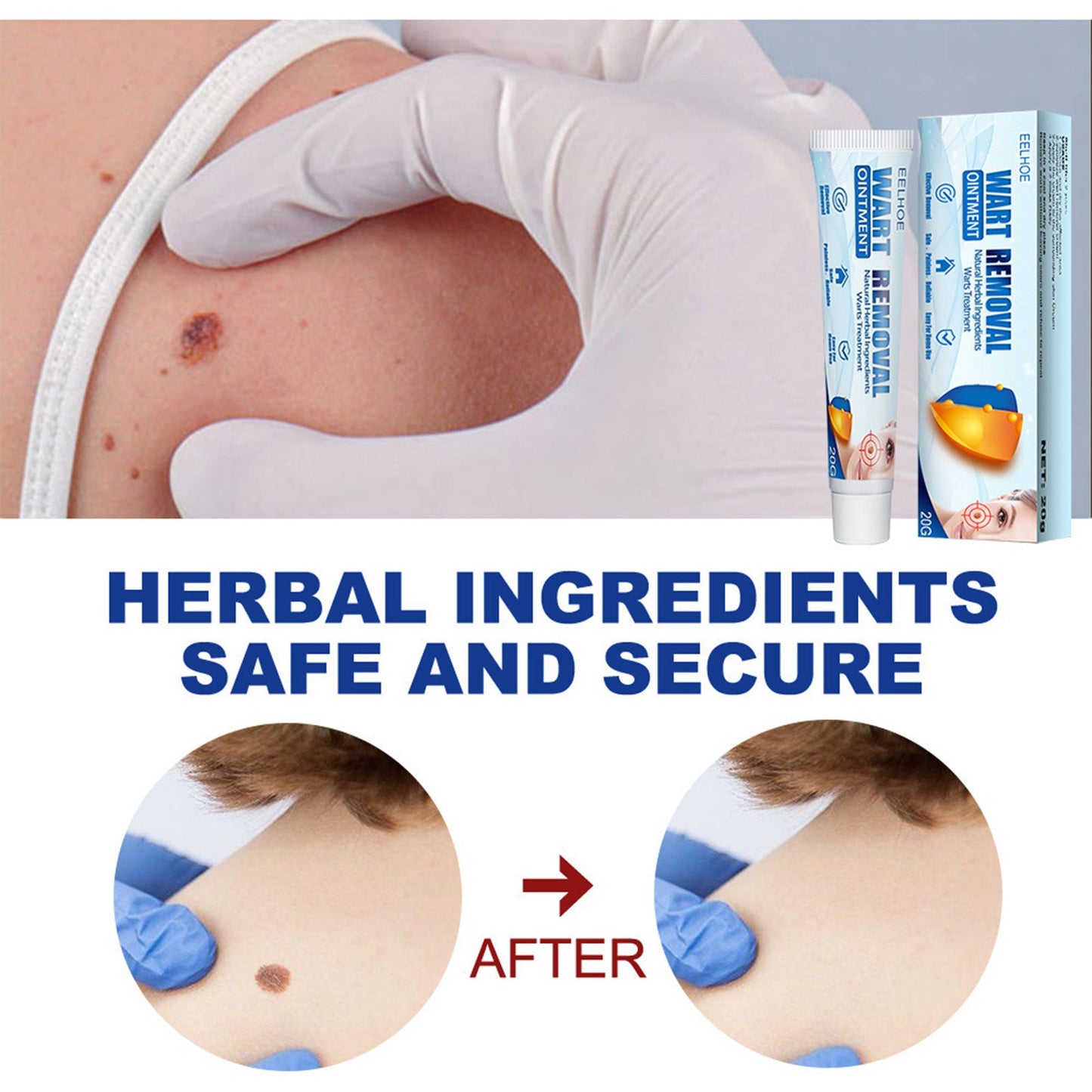 EELHOE Fragrance Removing Cream, Cleansing Skin Repair Care Body Face